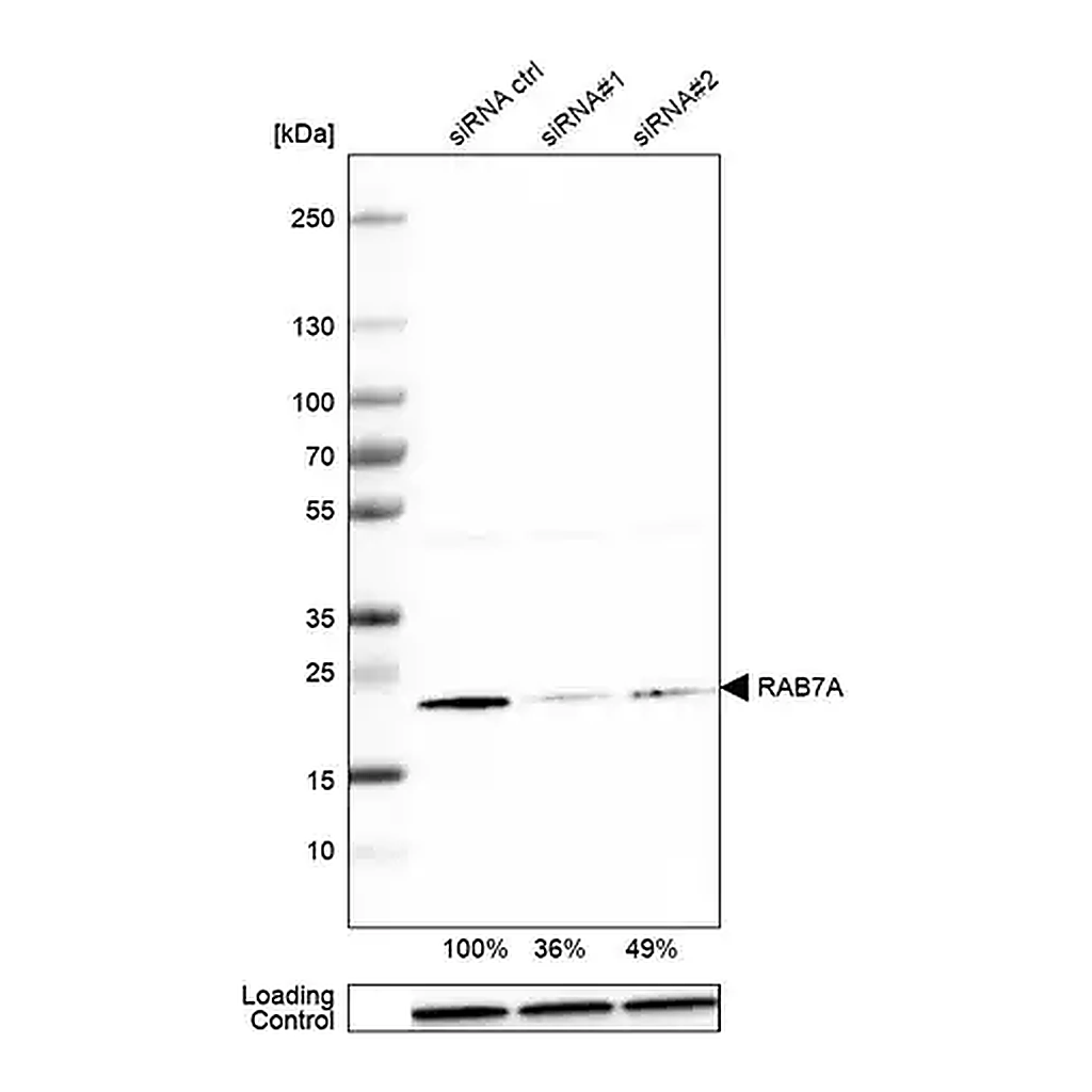 Merck Anti-RAB7A antibody produced in rabbit
