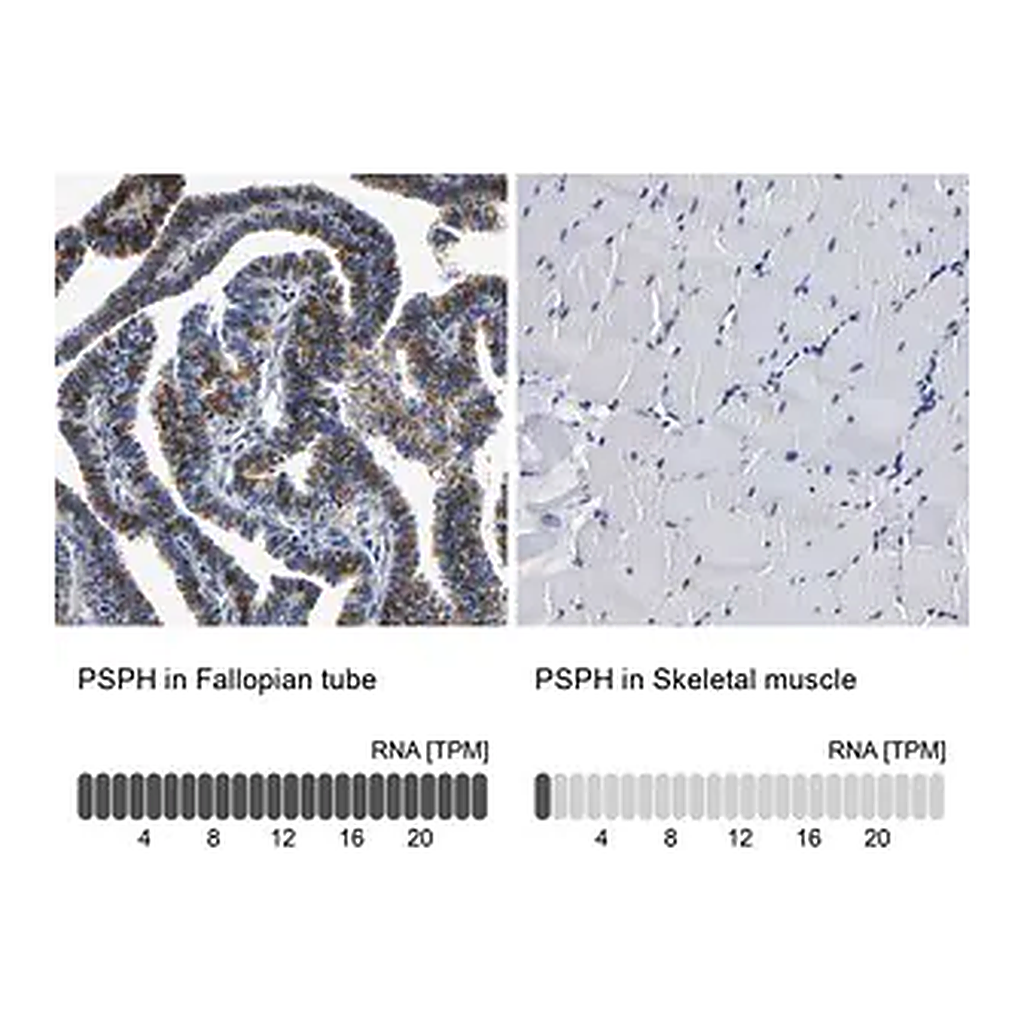 Merck Anti-PSPH antibody produced in rabbit