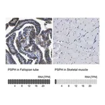Merck Anti-PSPH antibody produced in rabbit