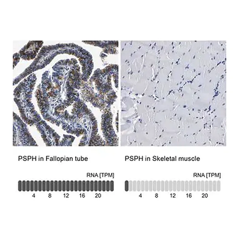 Merck Anti-PSPH antibody produced in rabbit