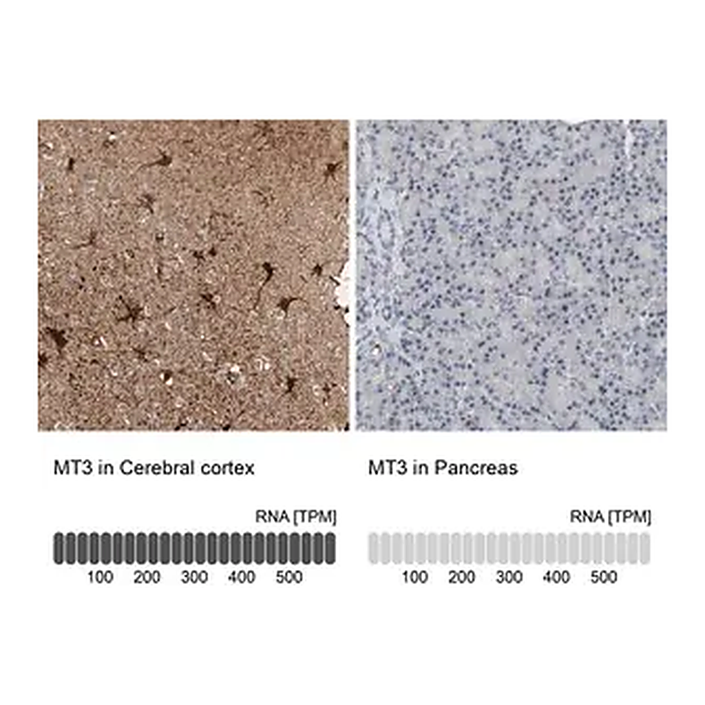 Merck Anti-MT3 antibody produced in rabbit