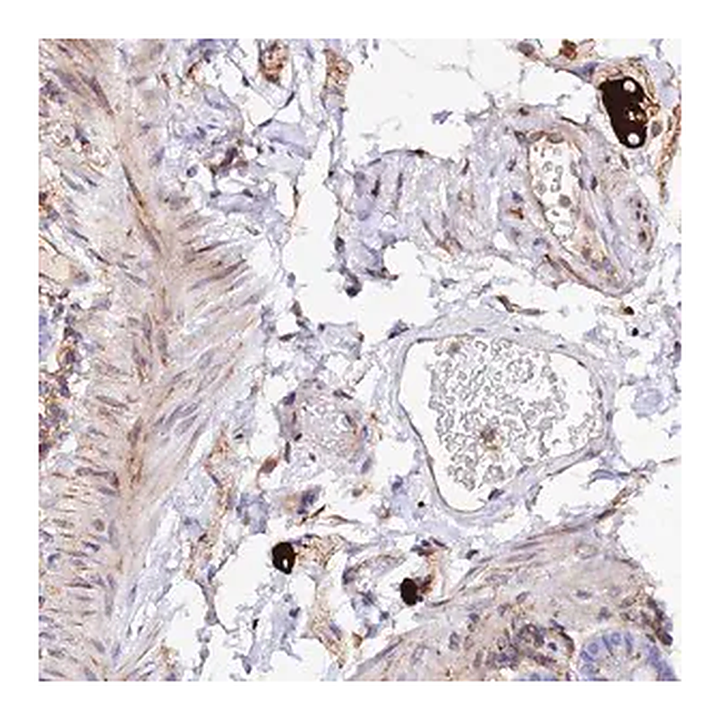 Merck Anti-TRPV2 antibody produced in rabbit