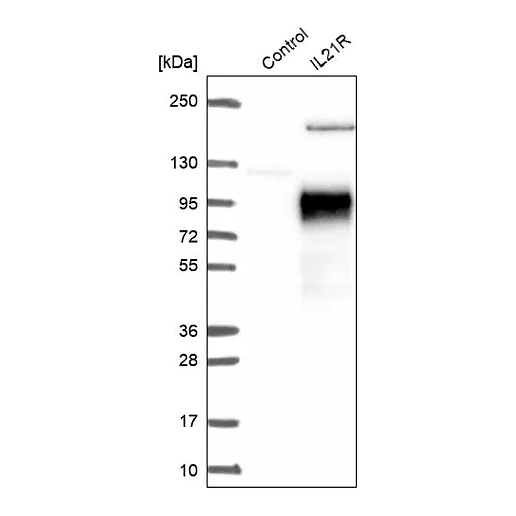 Merck Anti-IL21R antibody produced in rabbit
