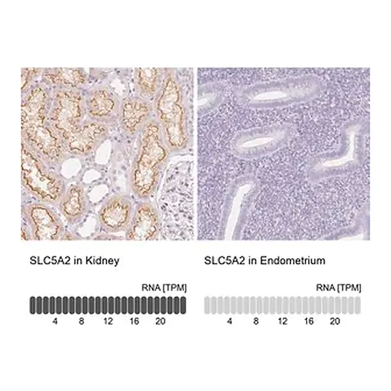 Merck Anti-SLC5A2 antibody produced in rabbit