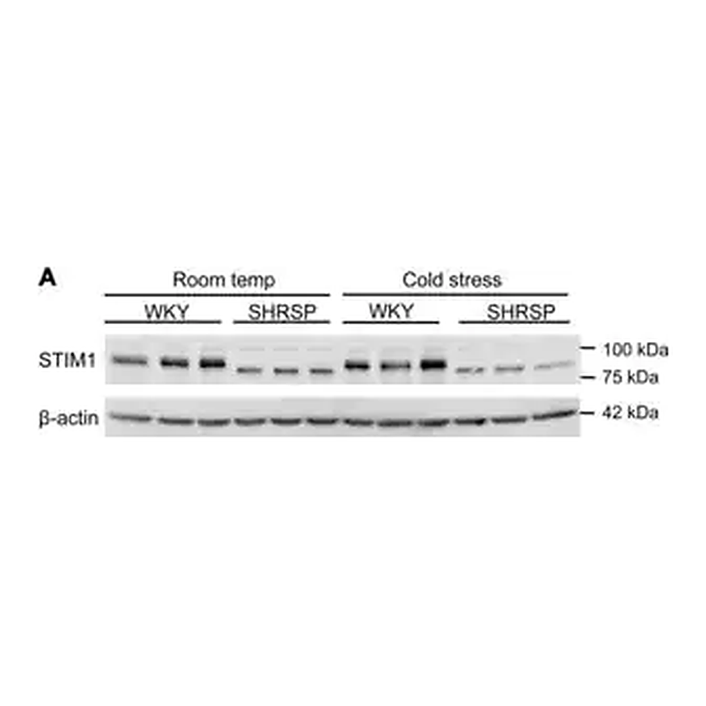 Merck Anti-STIM1 (N-terminal) antibody produced in rabbit