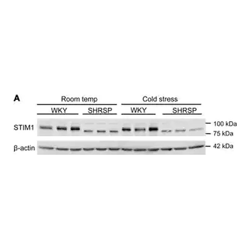 Merck Anti-STIM1 (N-terminal) antibody produced in rabbit