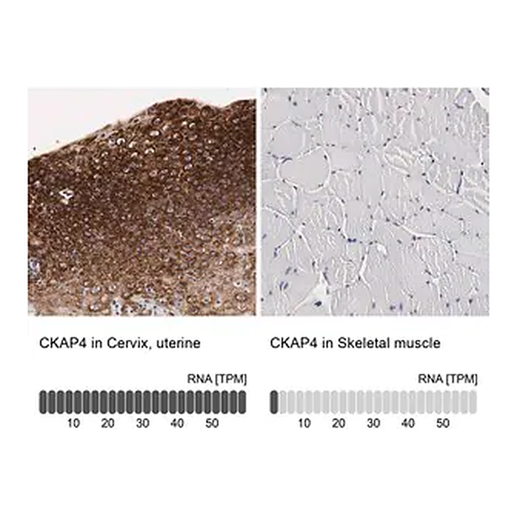 Merck Anti-CKAP4 antibody produced in rabbit