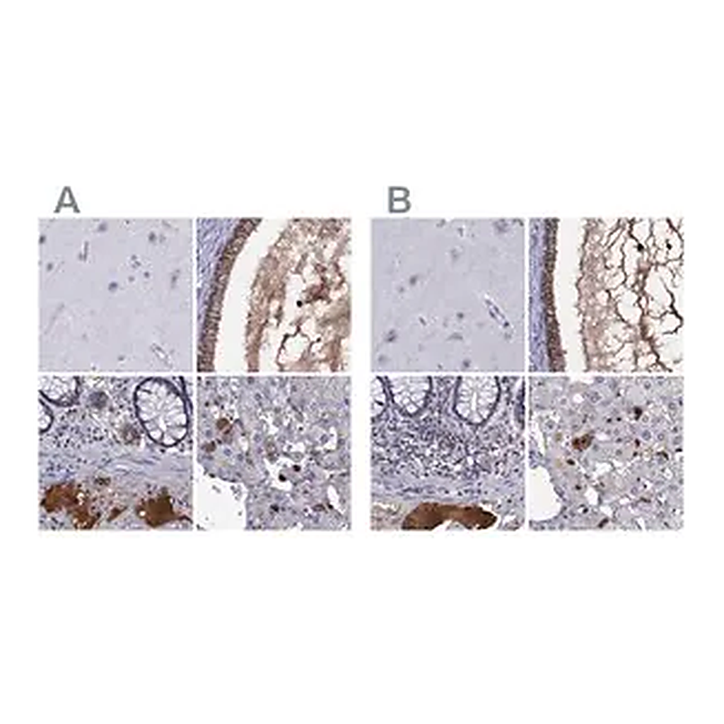 Merck Anti-SERPINA3 antibody produced in rabbit