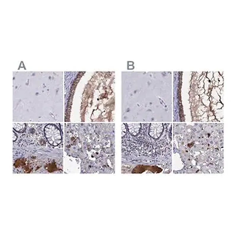 Merck Anti-SERPINA3 antibody produced in rabbit