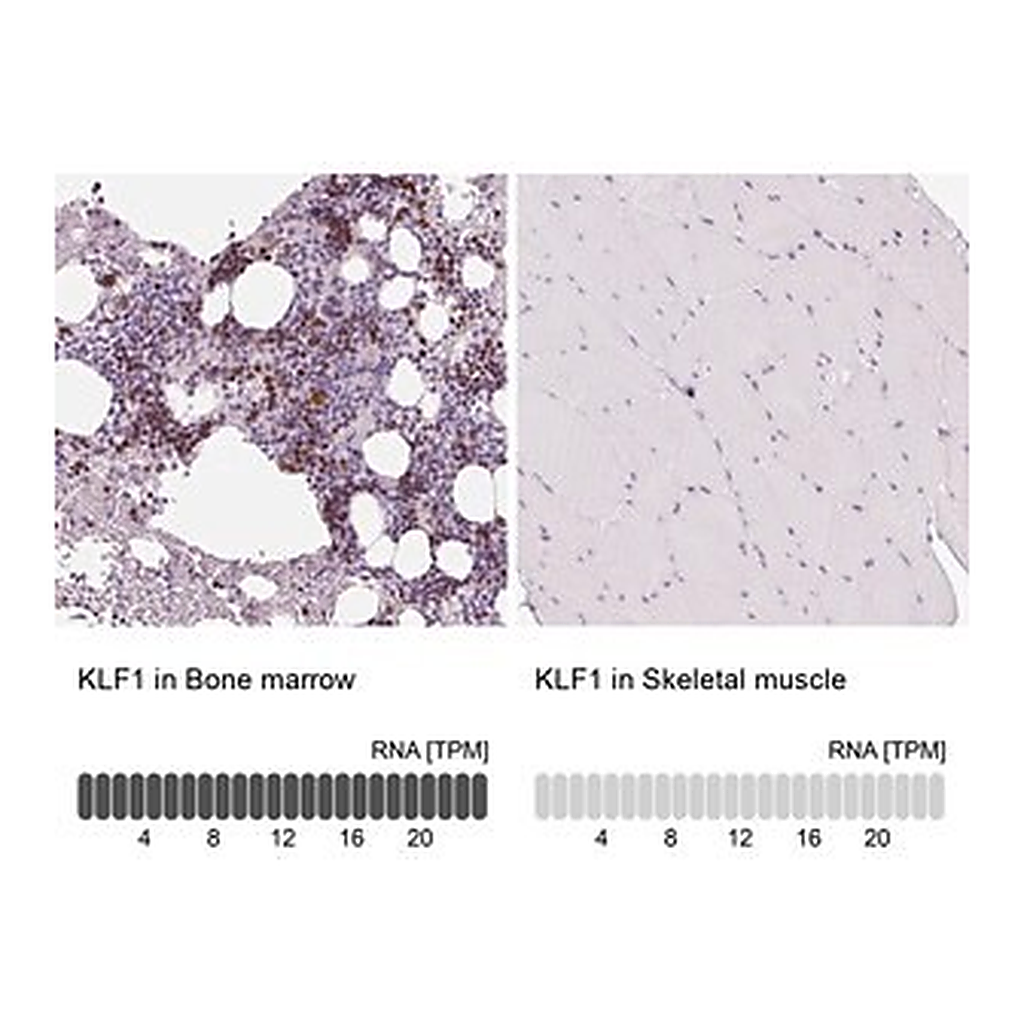 Merck Anti-KLF1 antibody produced in rabbit