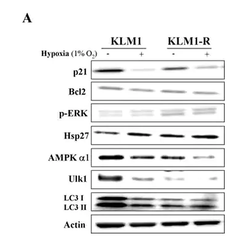 Merck Anti-ULK1 antibody produced in rabbit