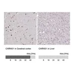 Merck Anti-CARNS1 antibody produced in rabbit