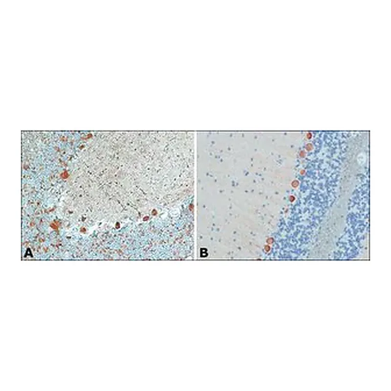 Merck Anti-Myosin Va (LF-18) antibody produced in rabbit