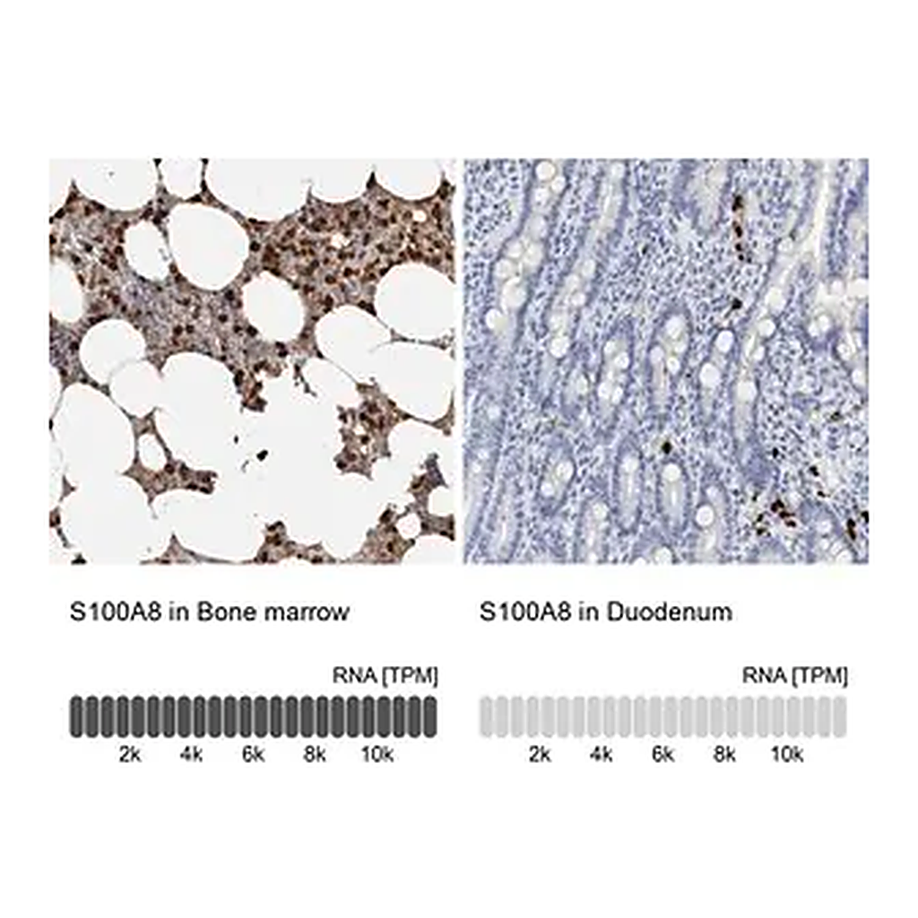 Merck Anti-S100A8 antibody produced in rabbit