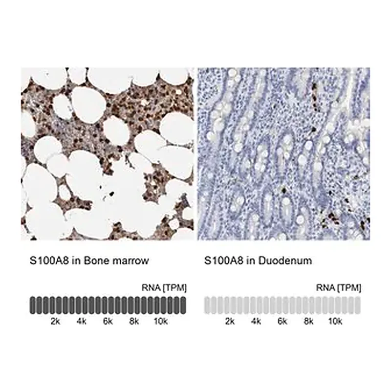 Merck Anti-S100A8 antibody produced in rabbit