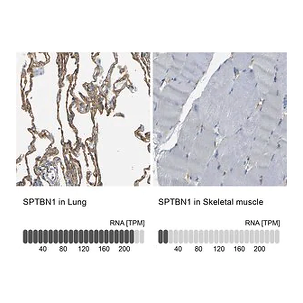 Merck Anti-SPTBN1 antibody produced in rabbit