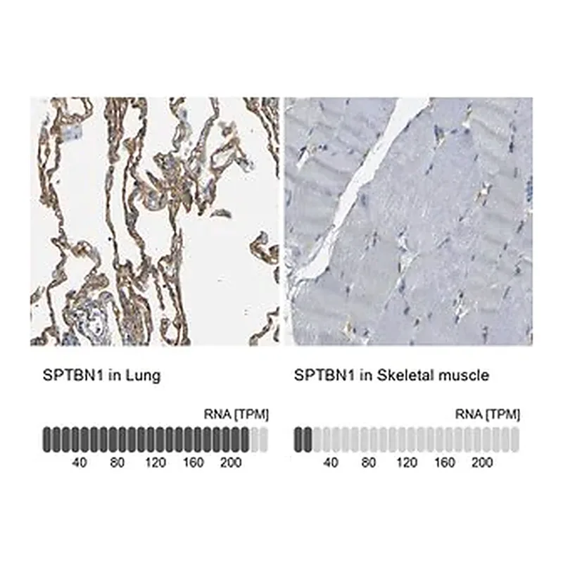 Merck Anti-SPTBN1 antibody produced in rabbit