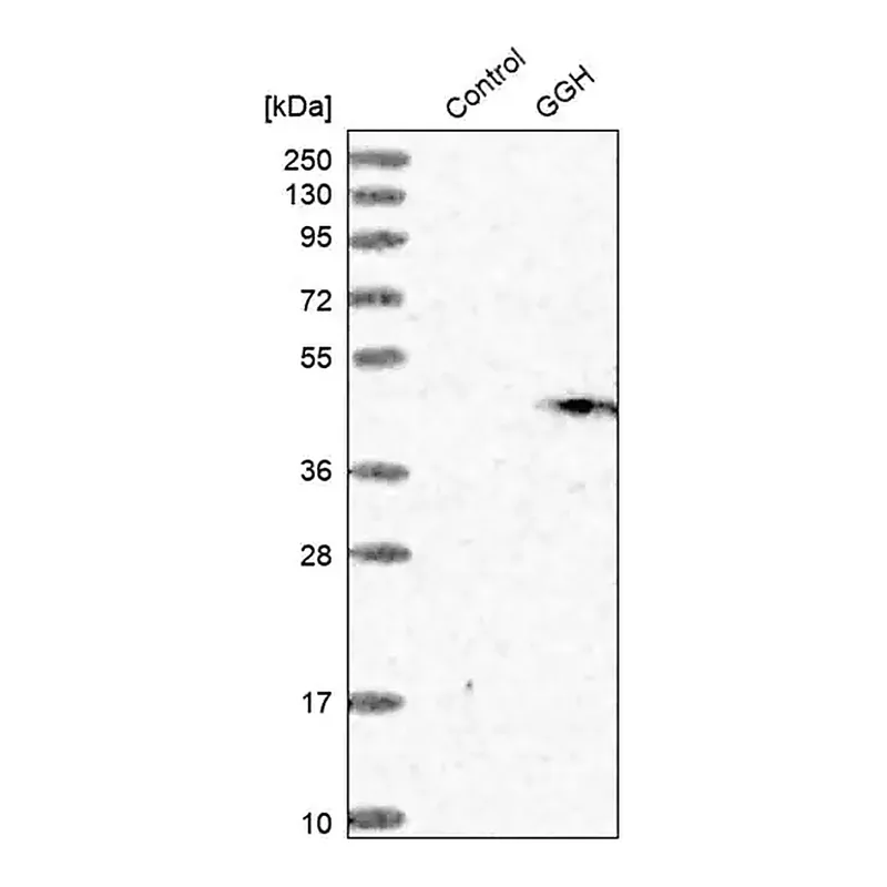 Merck Anti-GGH antibody produced in rabbit