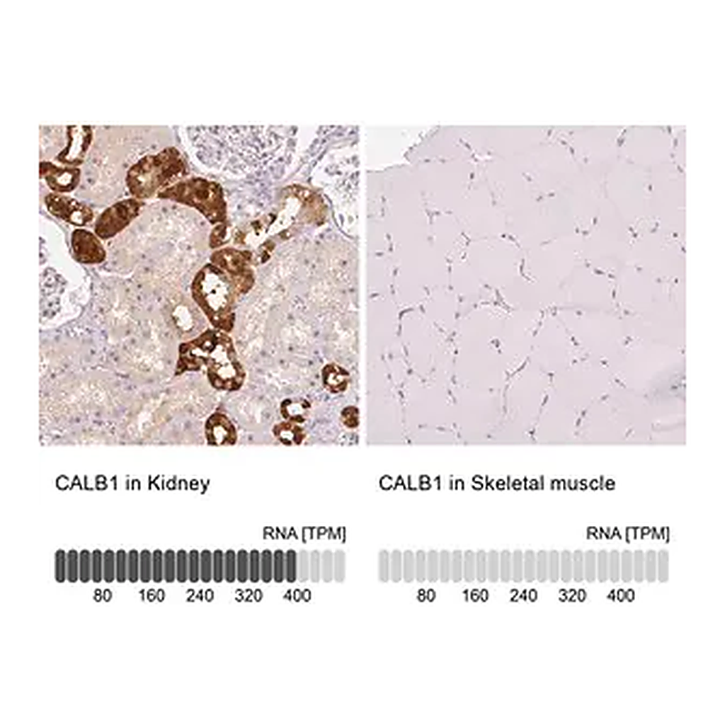 Merck Anti-CALB1 antibody produced in rabbit