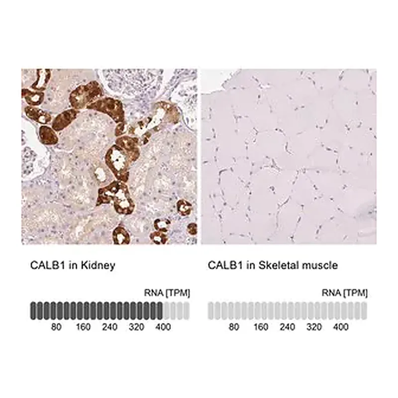 Merck Anti-CALB1 antibody produced in rabbit