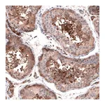 Merck Anti-OSBP2 antibody produced in rabbit