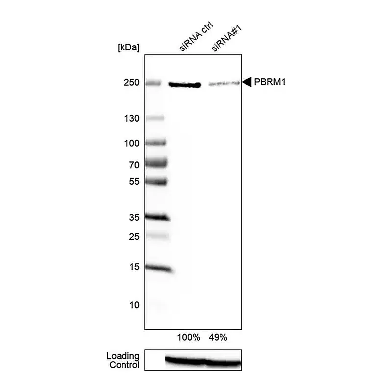 Merck Anti-PBRM1 antibody produced in rabbit