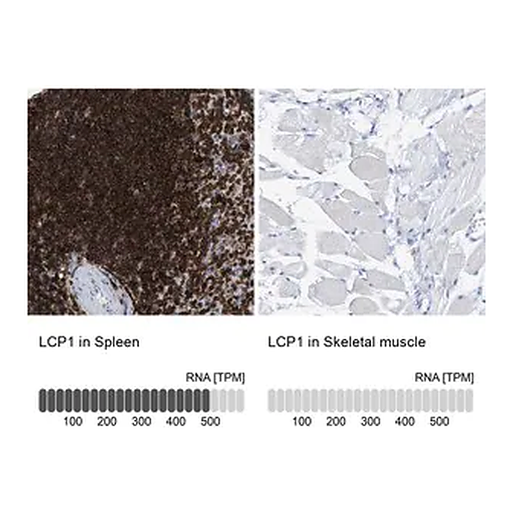 Merck Anti-LCP1 antibody produced in rabbit