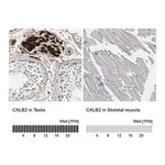 Merck Anti-CALB2 antibody produced in rabbit