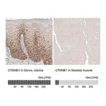 Merck Anti-CTNNB1 antibody produced in rabbit