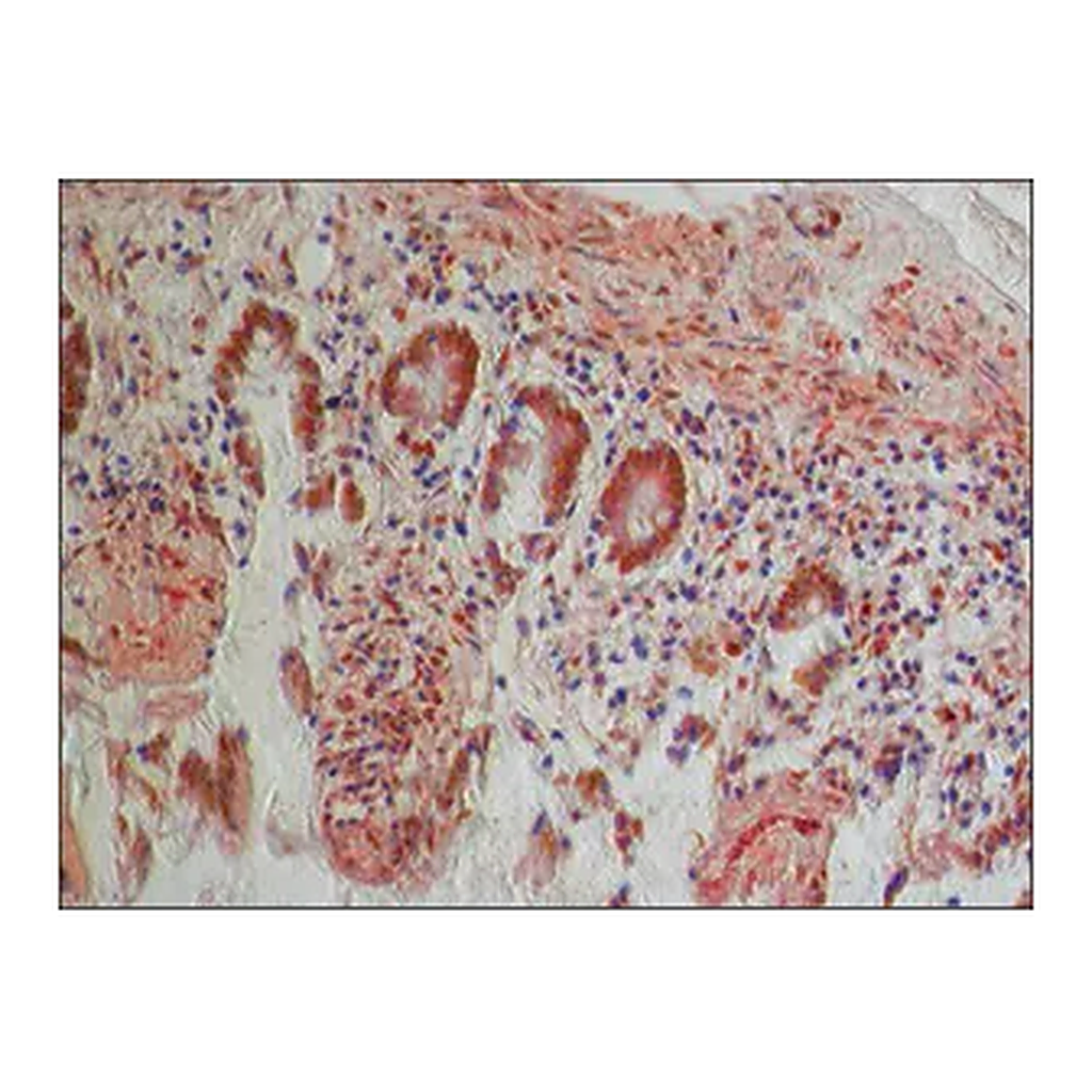 Merck Anti-PKM2 (isoform M1) antibody produced in rabbit