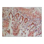 Merck Anti-PKM2 (isoform M1) antibody produced in rabbit