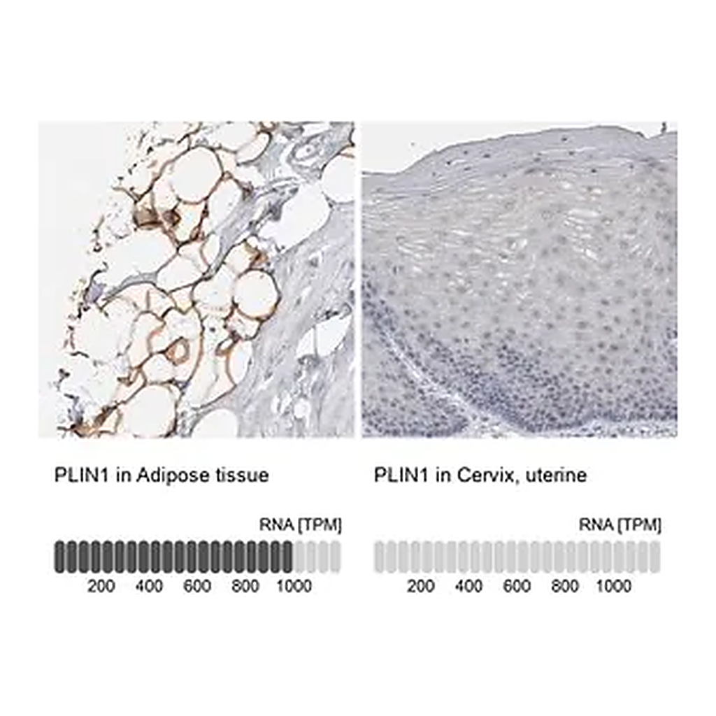 Merck Anti-PLIN1 antibody produced in rabbit