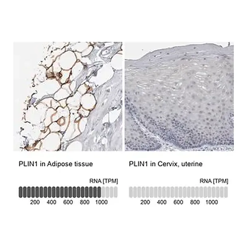 Merck Anti-PLIN1 antibody produced in rabbit