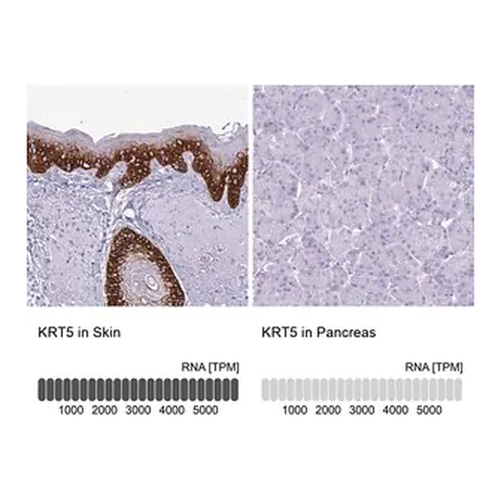 Merck Anti-KRT5 antibody produced in rabbit