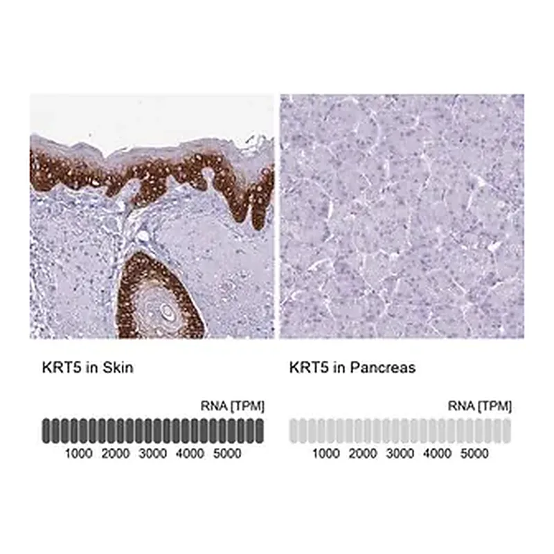 Merck Anti-KRT5 antibody produced in rabbit