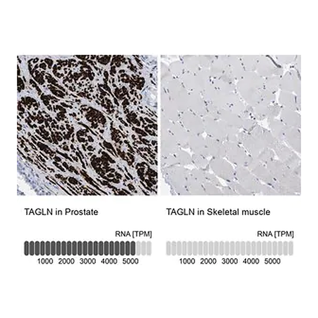 Merck Anti-TAGLN antibody produced in rabbit