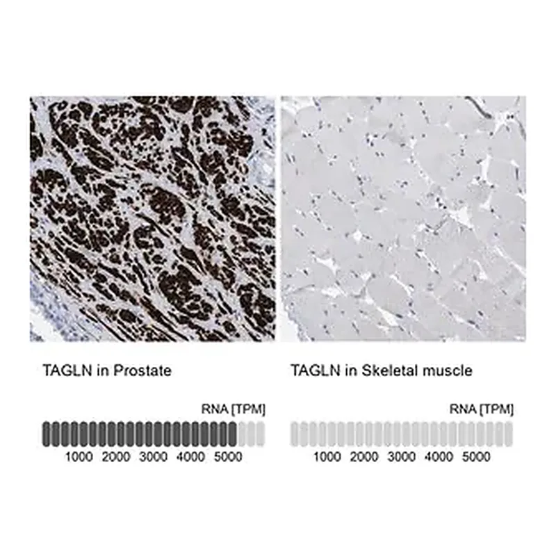 Merck Anti-TAGLN antibody produced in rabbit