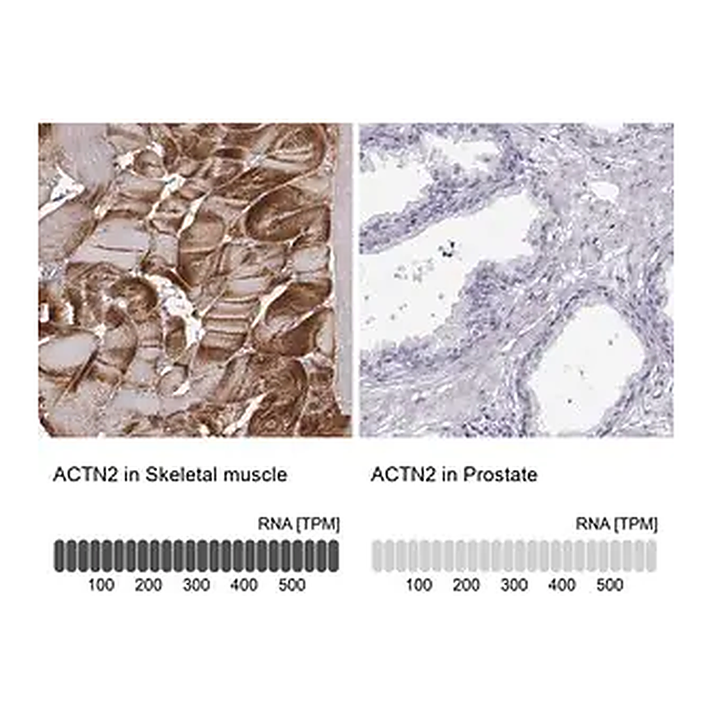 Merck Anti-ACTN2 antibody produced in rabbit