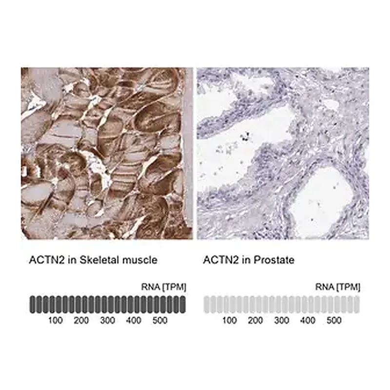 Merck Anti-ACTN2 antibody produced in rabbit