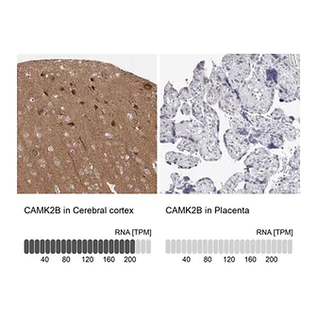 Merck Anti-CAMK2B antibody produced in rabbit