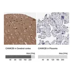 Merck Anti-CAMK2B antibody produced in rabbit