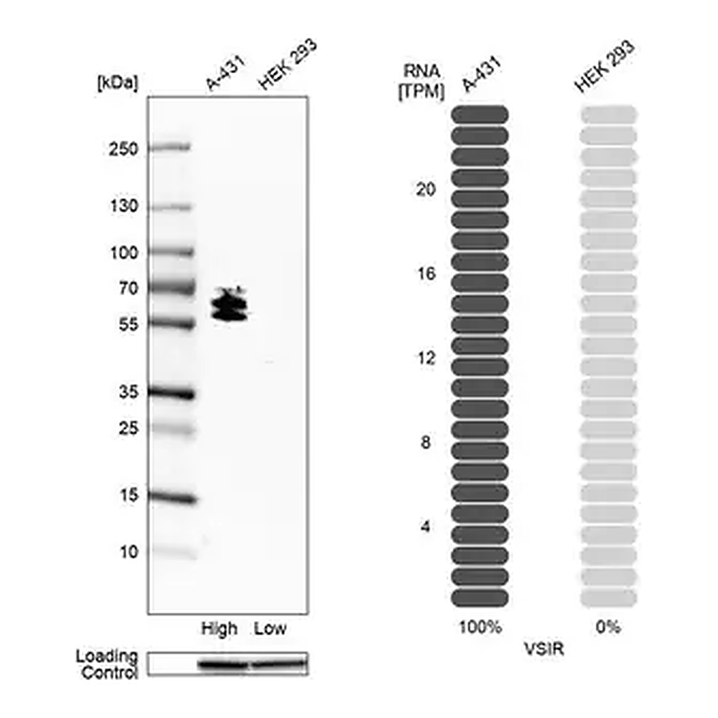 Merck Anti-VSIR antibody produced in rabbit