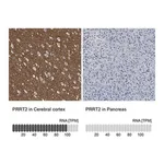 Merck Anti-PRRT2 antibody produced in rabbit
