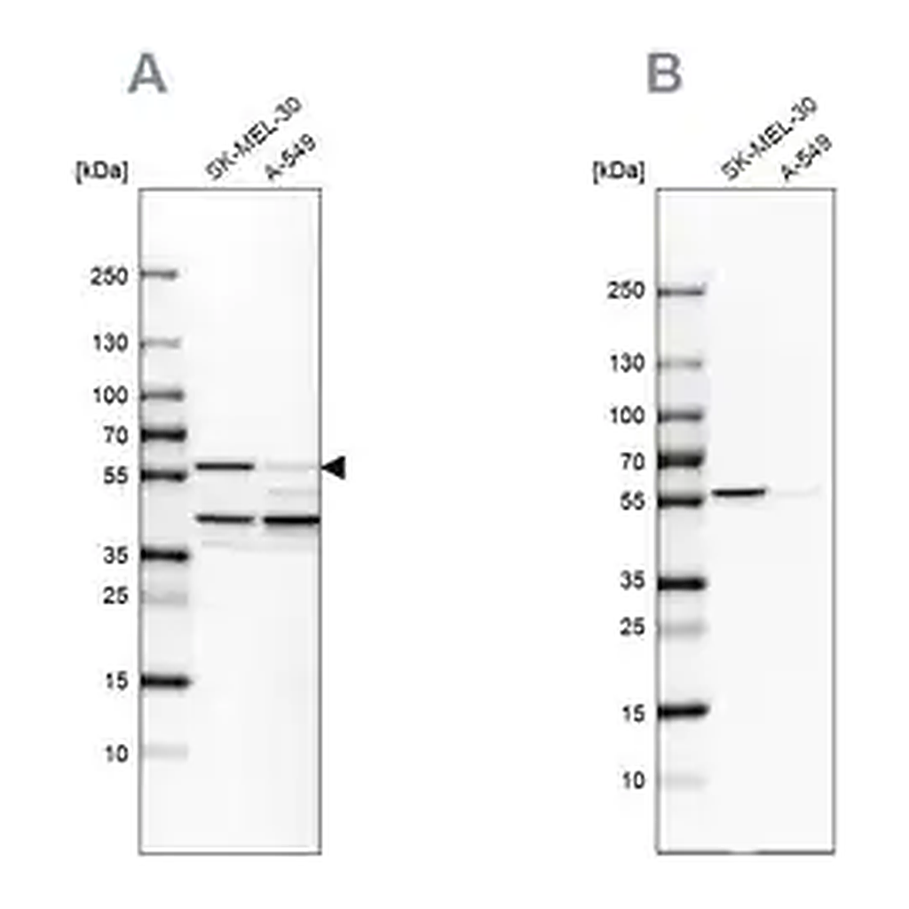 Merck Anti-PHGDH antibody produced in rabbit