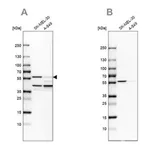 Merck Anti-PHGDH antibody produced in rabbit