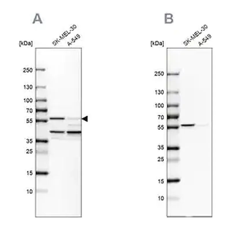 Merck Anti-PHGDH antibody produced in rabbit