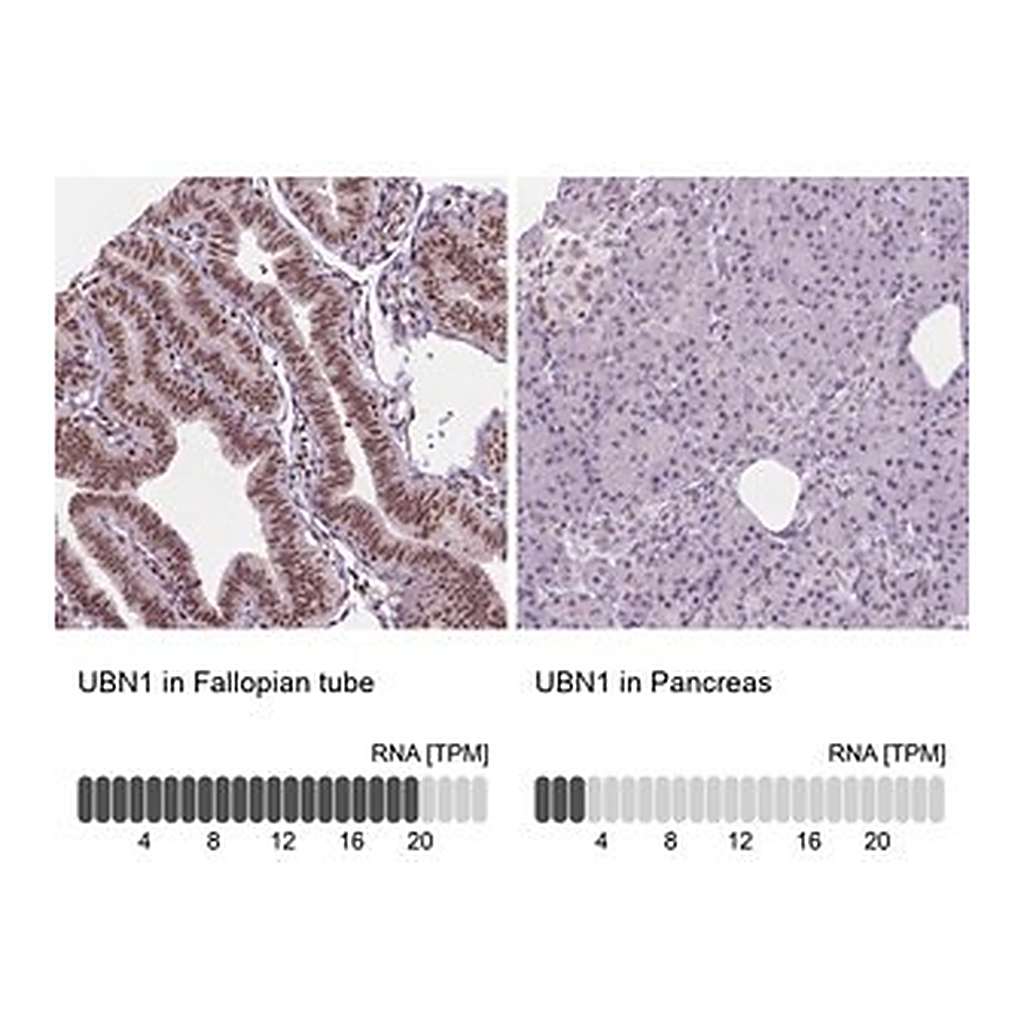 Merck Anti-UBN1 antibody produced in rabbit