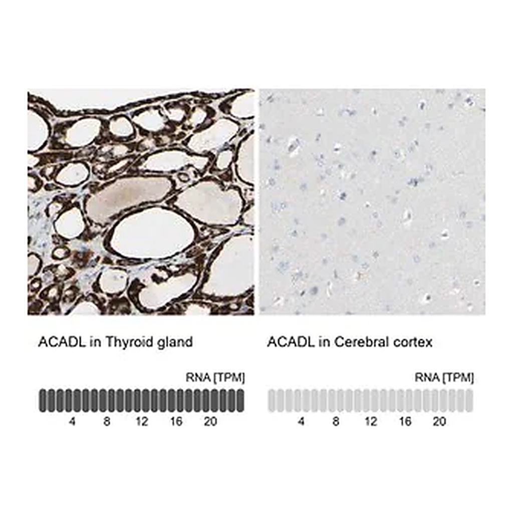 Merck Anti-ACADL antibody produced in rabbit