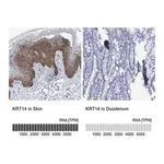 Merck Anti-KRT14 antibody produced in rabbit