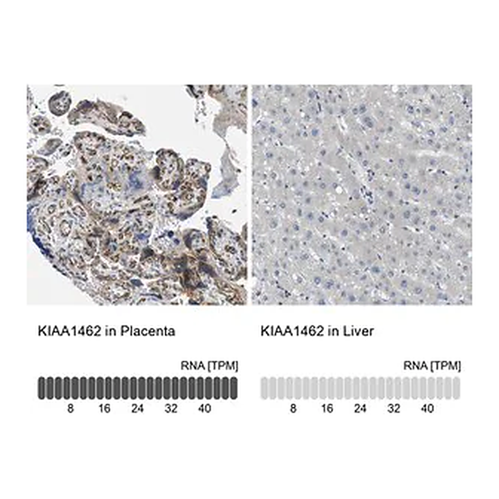 Merck Anti-KIAA1462 antibody produced in rabbit